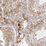 TCTEX1D1 Polyclonal Antibody