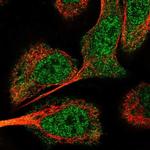 USP24 Polyclonal Antibody