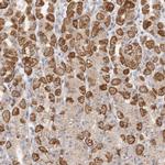 USP24 Antibody in Immunohistochemistry (IHC)