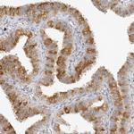 C1orf102 Antibody in Immunohistochemistry (IHC)