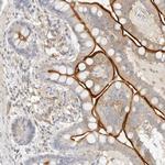 C1orf102 Antibody in Immunohistochemistry (IHC)