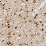 C1orf102 Antibody in Immunohistochemistry (IHC)