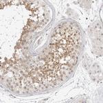 C1orf102 Polyclonal Antibody