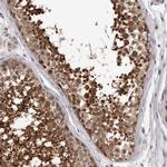 MED8 Antibody in Immunohistochemistry (IHC)