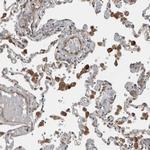 YOD1 Antibody in Immunohistochemistry (Paraffin) (IHC (P))