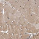 YOD1 Antibody in Immunohistochemistry (Paraffin) (IHC (P))