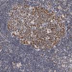 USP1 Antibody in Immunohistochemistry (Paraffin) (IHC (P))