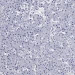 USP1 Antibody in Immunohistochemistry (Paraffin) (IHC (P))