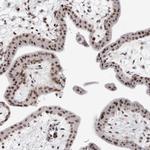 USP1 Antibody in Immunohistochemistry (Paraffin) (IHC (P))