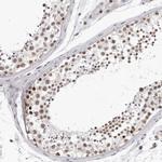USP1 Antibody in Immunohistochemistry (Paraffin) (IHC (P))