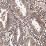 ADAMTS2 Antibody in Immunohistochemistry (Paraffin) (IHC (P))