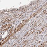 ADAMTS2 Antibody in Immunohistochemistry (Paraffin) (IHC (P))