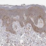 ADAMTS2 Antibody in Immunohistochemistry (Paraffin) (IHC (P))