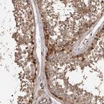 ADAMTS2 Antibody in Immunohistochemistry (Paraffin) (IHC (P))