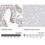HEXIM2 Antibody in Immunohistochemistry (IHC)