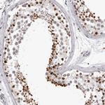 HEXIM2 Antibody in Immunohistochemistry (IHC)