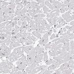 HEXIM2 Antibody in Immunohistochemistry (IHC)