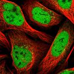 ZNF326 Antibody in Immunocytochemistry (ICC/IF)