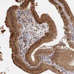 ZNF326 Antibody in Immunohistochemistry (Paraffin) (IHC (P))