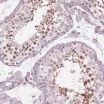 FAM71A Antibody in Immunohistochemistry (IHC)