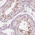 FAM71A Polyclonal Antibody