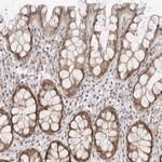 ITGB3BP Antibody in Immunohistochemistry (IHC)