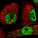 ZNF326 Antibody in Immunocytochemistry (ICC/IF)