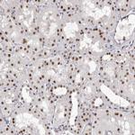 ZNF326 Antibody in Immunohistochemistry (Paraffin) (IHC (P))