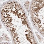 SDE2 Antibody in Immunohistochemistry (Paraffin) (IHC (P))