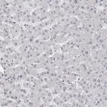 EXOSC10 Antibody in Immunohistochemistry (Paraffin) (IHC (P))