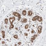 DIRAS3 Polyclonal Antibody