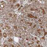 EXOSC10 Antibody in Immunohistochemistry (Paraffin) (IHC (P))