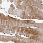 FLAD1 Antibody in Immunohistochemistry (Paraffin) (IHC (P))