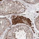 FLAD1 Antibody in Immunohistochemistry (Paraffin) (IHC (P))