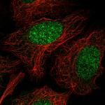 NENF Polyclonal Antibody