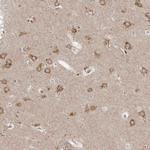 NENF Antibody in Immunohistochemistry (IHC)