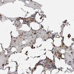 TRMT13 Polyclonal Antibody