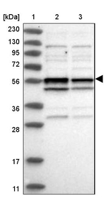TRMT13 Antibody in Western Blot (WB)