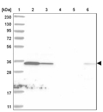 C1orf74 Antibody in Western Blot (WB)