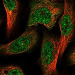 AGL Polyclonal Antibody