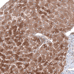 AGL Antibody in Immunohistochemistry (Paraffin) (IHC (P))
