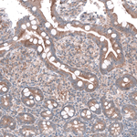 AGL Antibody in Immunohistochemistry (Paraffin) (IHC (P))