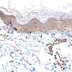 AGL Antibody in Immunohistochemistry (Paraffin) (IHC (P))