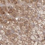 NUP43 Polyclonal Antibody