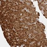 ZNF678 Antibody in Immunohistochemistry (Paraffin) (IHC (P))