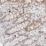 ZNF678 Antibody in Immunohistochemistry (Paraffin) (IHC (P))