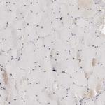 ZNF678 Antibody in Immunohistochemistry (Paraffin) (IHC (P))