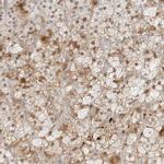 ZNF678 Antibody in Immunohistochemistry (IHC)