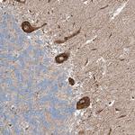 RUSC1 Antibody in Immunohistochemistry (Paraffin) (IHC (P))