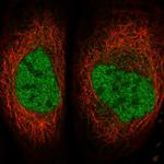 SERTAD4 Polyclonal Antibody